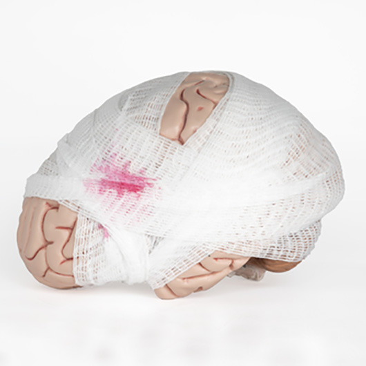 A brain with a bandage wrapped around it showing what happens with concussions.