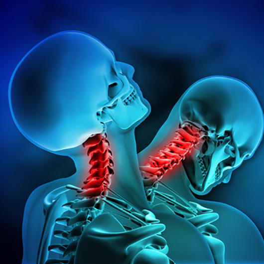 What happens with Whiplash Injuries and how Upper Cervical Spine Center can help.